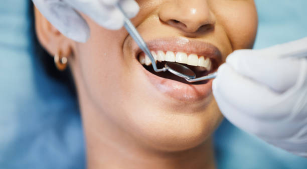Best Emergency Dentist for Knocked-Out Tooth in Augusta, KS